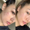 GlowLift™- Face Lifter
