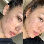 GlowLift™- Face Lifter